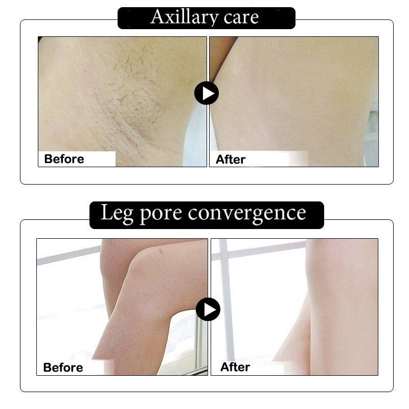 2020 Armpit Underarm Whitening Cream, Body Whitening Cream, , Legs , Knees , Private Parts, Cosmetics Skin Care . - Image 4
