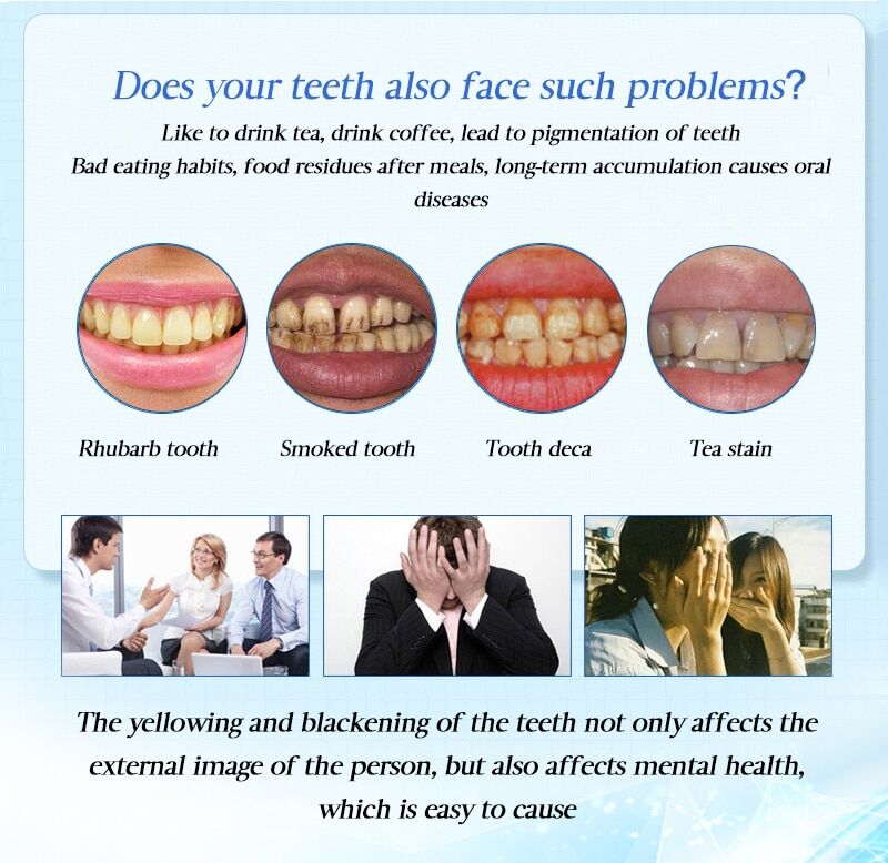 White Teeth , Whitening Pen Tooth , Gel Whitener Bleach Remove Plaque Stains , Dental Tools Oral Hygiene Teeth Cleaning Serum. - Image 4
