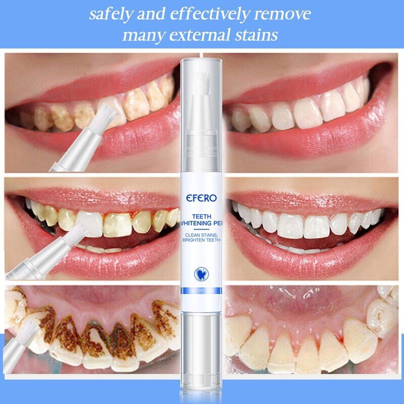 White Teeth , Whitening Pen Tooth , Gel Whitener Bleach Remove Plaque Stains , Dental Tools Oral Hygiene Teeth Cleaning Serum. - Image 6