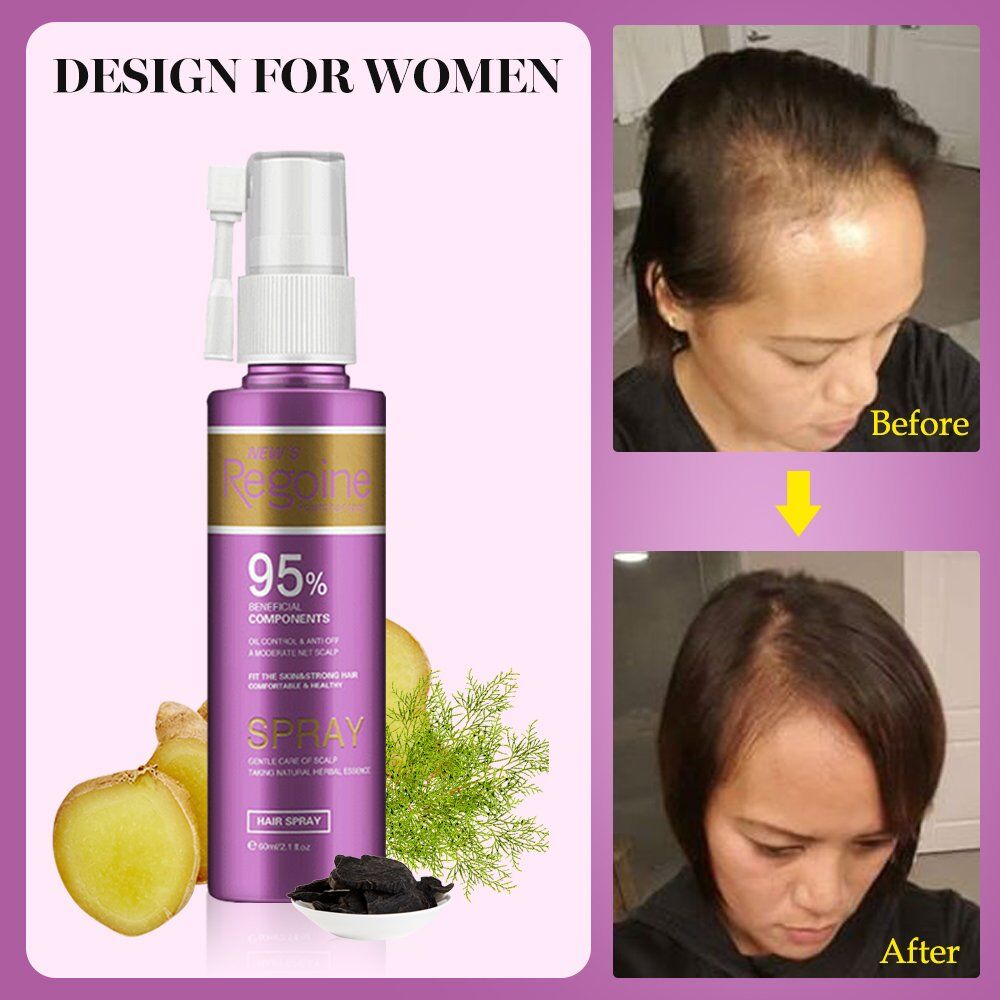 Hair Growth Treatment, Oil for Anti Hair Loss , Essence Fast Thick Hair , Eyebrows , Support Natural Healthy Hair , Treatment for Women. - Image 3