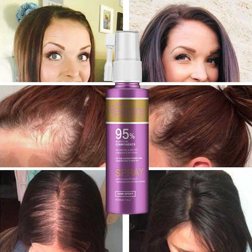Hair Growth Treatment, Oil for Anti Hair Loss , Essence Fast Thick Hair , Eyebrows , Support Natural Healthy Hair , Treatment for Women. - Image 4