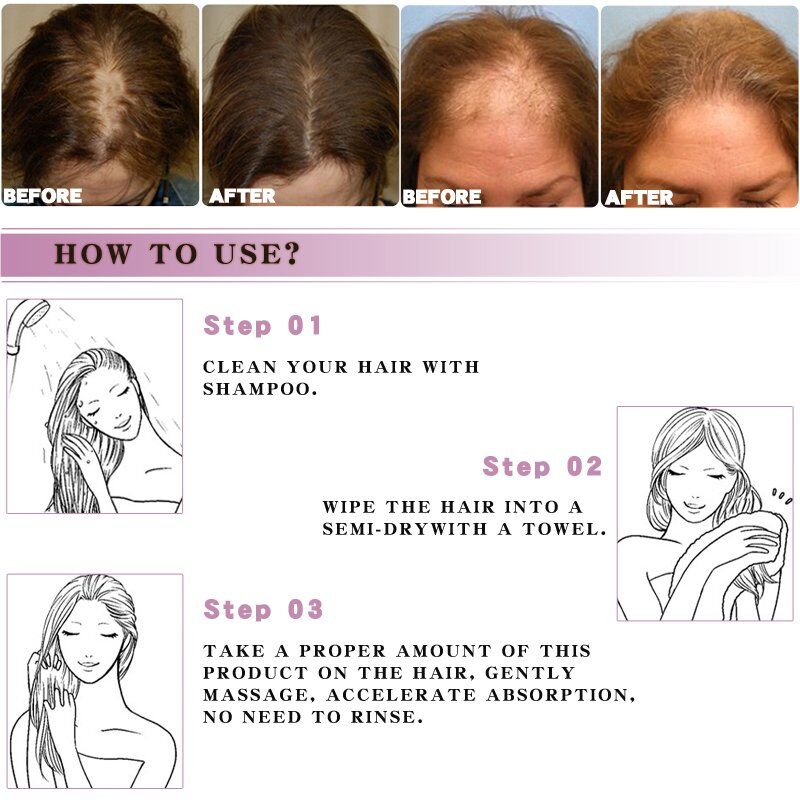 Moroccan Prevent Hair . Loss Product Hair . Growth Essential Oil ,Easy To Carry, Hair Care Nursing . - Image 5