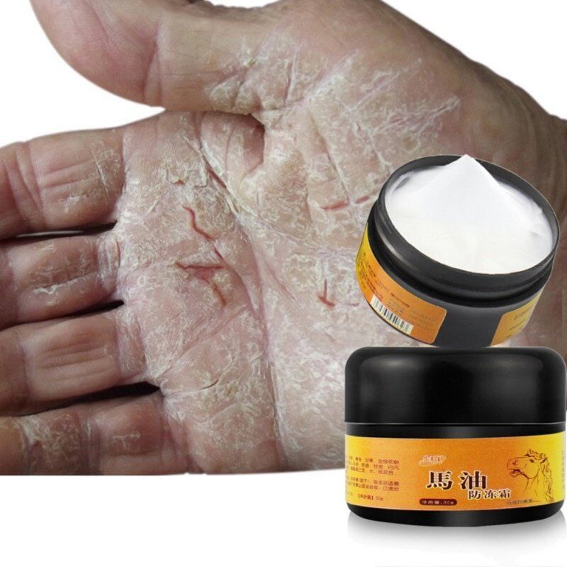 Natural Horse Oil . Foot Cream. Anti-Chapping Skin. Repairing Moisturizing. Remove Rough Dry and Cracked Chapped Feet Heel. - Image 2