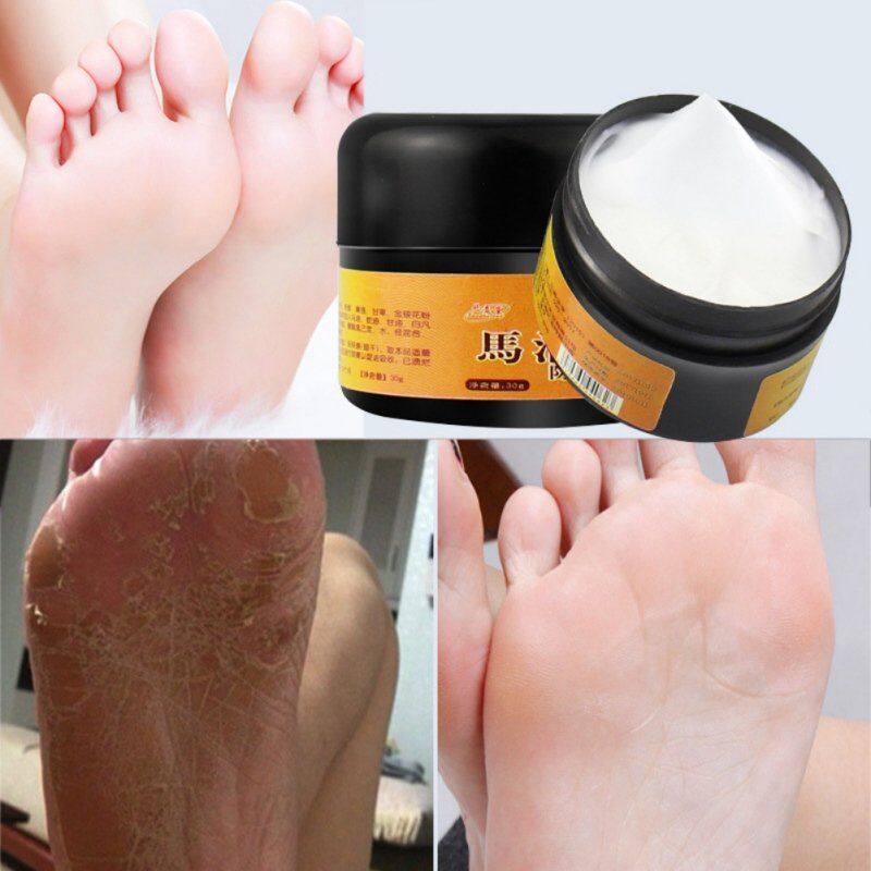 Natural Horse Oil . Foot Cream. Anti-Chapping Skin. Repairing Moisturizing. Remove Rough Dry and Cracked Chapped Feet Heel. - Image 4