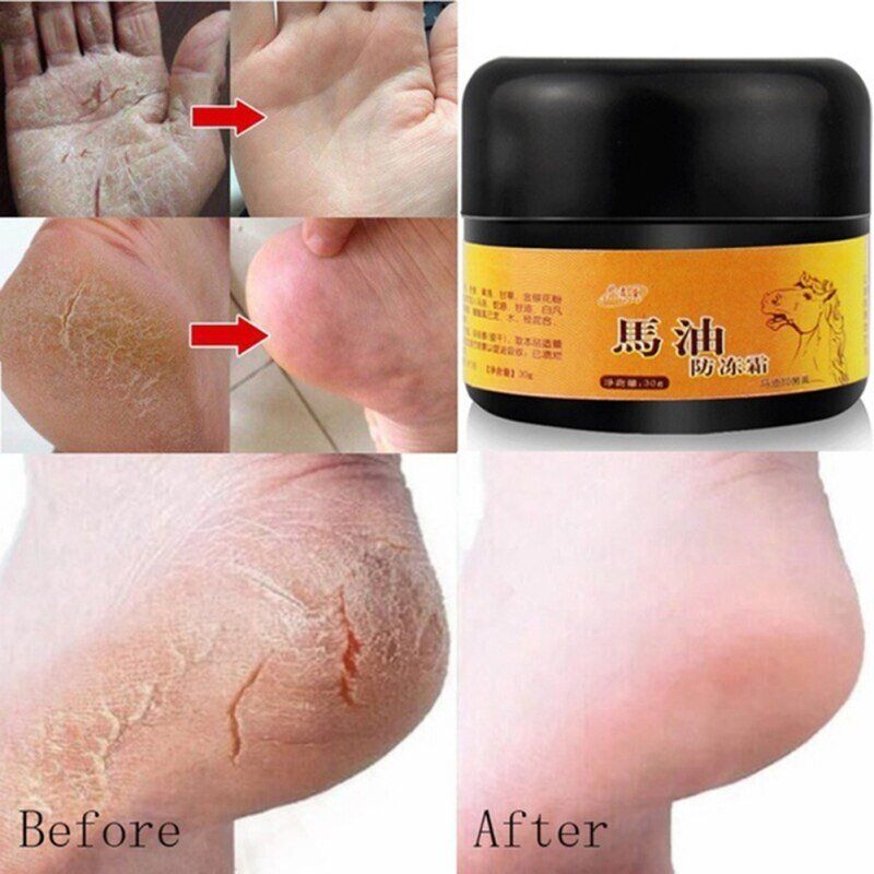 Natural Horse Oil . Foot Cream. Anti-Chapping Skin. Repairing Moisturizing. Remove Rough Dry and Cracked Chapped Feet Heel. - Image 6