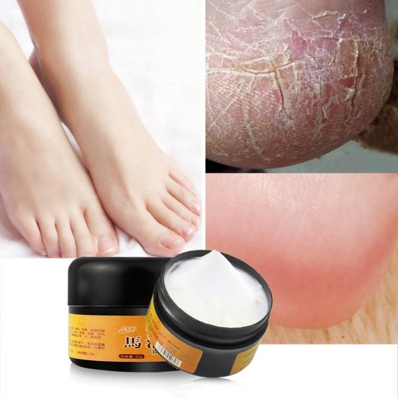 Natural Horse Oil . Foot Cream. Anti-Chapping Skin. Repairing Moisturizing. Remove Rough Dry and Cracked Chapped Feet Heel.