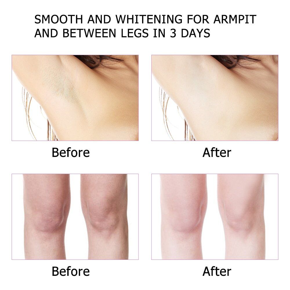 US Stock Armpit , Whitening Body Creams, Between Legs , Knees, Private Parts , Whitening Underarm , Whitener Intimate, Body Care Cream. - Image 4