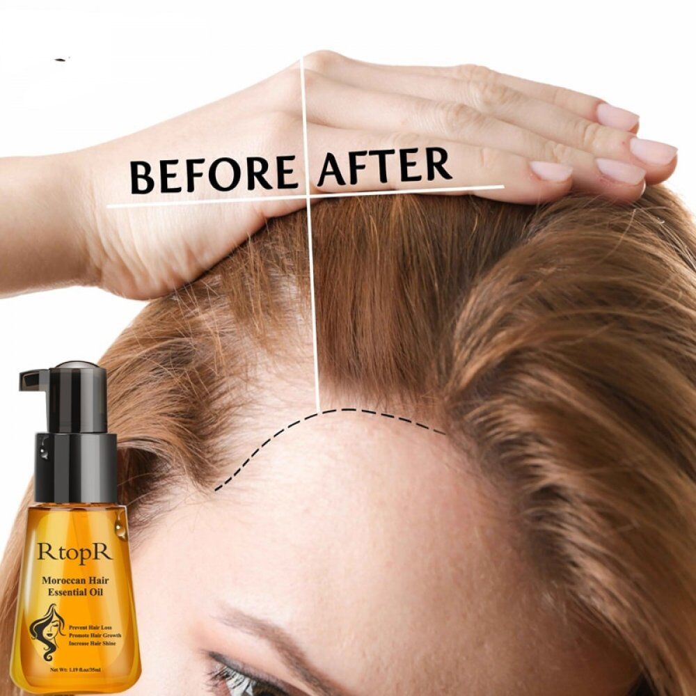 Moroccan Prevent Hair . Loss Product Hair . Growth Essential Oil ,Easy To Carry, Hair Care Nursing . - Image 3