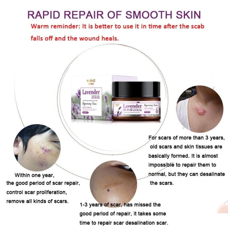 Lavender Scar Repair Cream , Moisturizing Lighten Pigment, Remove Scars ,Pimple Marks Acne, Spots, Treatment, Whitening Cream 30g. #NP - Image 6