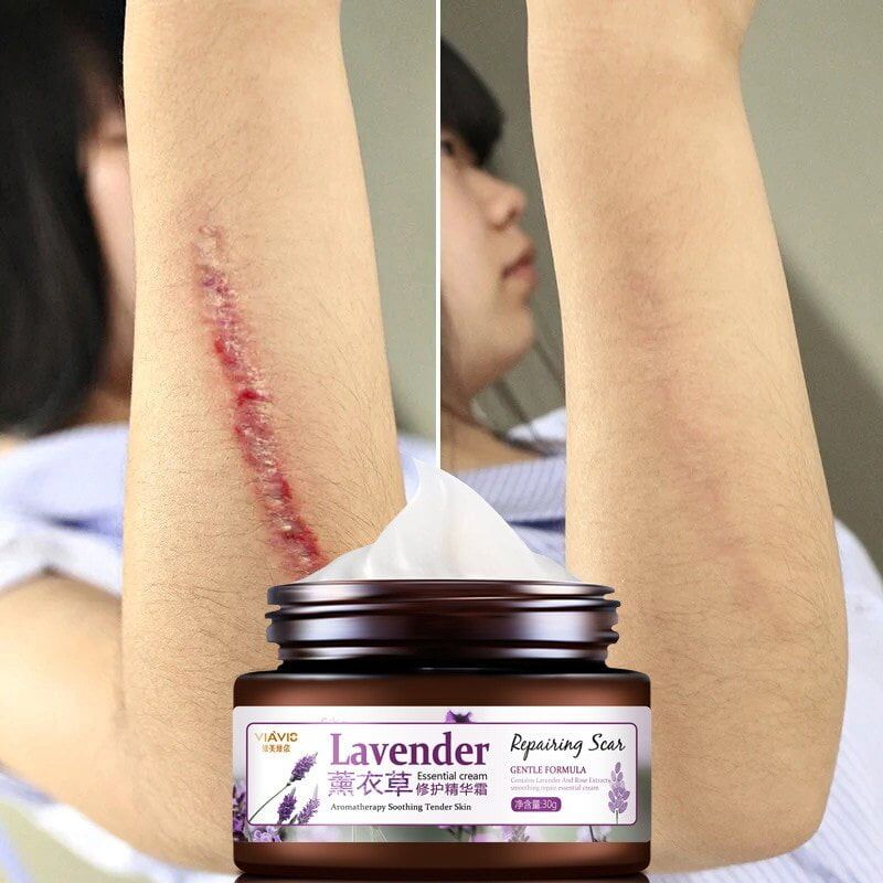 Lavender Scar Repair Cream , Moisturizing Lighten Pigment, Remove Scars ,Pimple Marks Acne, Spots, Treatment, Whitening Cream 30g. #NP